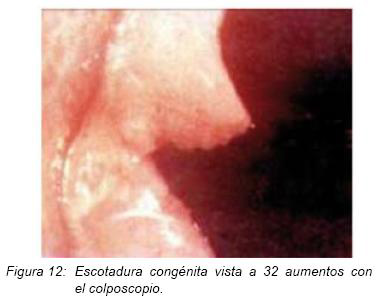 Que significa congenita