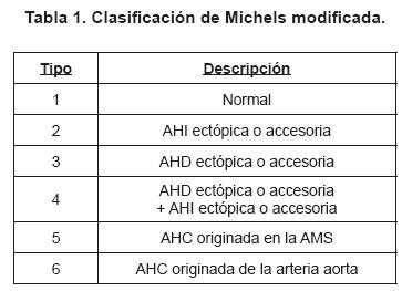 tabla