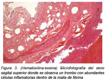 Figura