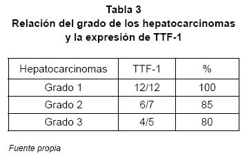 Tabla