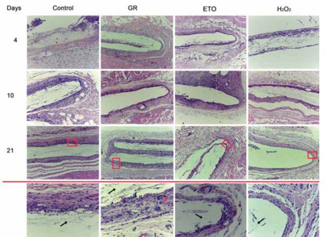 Physicochemical And Tissue Response Of Pla Nanofiber Scaffolds Sterilized By Different Techniques