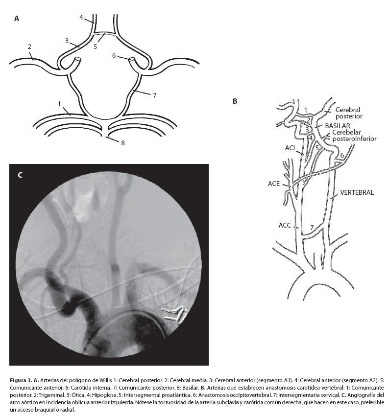 Arteria carótida interna: Anatomía, segmentos y ramas