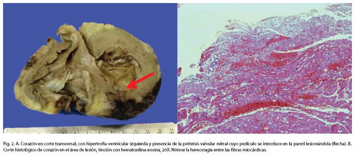 Figura2